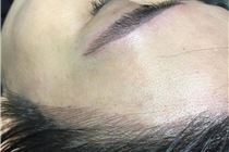 TUYỆT PHẨM NGŨ QUAN  CHO TÓC LƯA THƯA, TRÁN CAO, BÒ LIẾM TUYỆT PHẨM NGŨ QUAN  CHO TÓC LƯA THƯA, TRÁN CAO, BÒ LIẾM