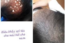 Điêu khắc tóc - Hair Simulation/Microblading Điêu khắc tóc - Hair Simulation/Microblading