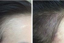 Điêu khắc tạo sợi tóc 8d, Xăm chân tóc Điêu khắc tạo sợi tóc 8d, Xăm chân tóc
