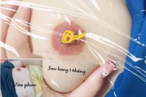 Phun Hồng nhũ Hoa cần bao lâu thời gian ? Phun Hồng nhũ Hoa cần bao lâu thời gian ?