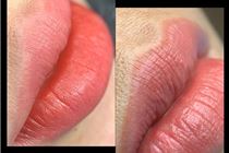 Bí quyết Khử Thâm Môi Hiệu Quả với Hồng Dâu