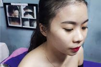 Điêu khắc tóc che vùng thưa tóc cho nữ tại TÍT MI Điêu khắc tóc che vùng thưa tóc cho nữ tại TÍT MI