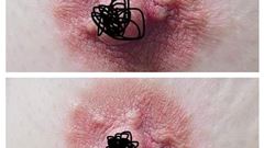 Phun Hồng Nhũ Hoa, Hồng Ti và Những Điều Cần Biết Phun Hồng Nhũ Hoa, Hồng Ti và Những Điều Cần Biết