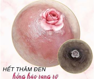 Phun xăm làm hồng nhũ hoa