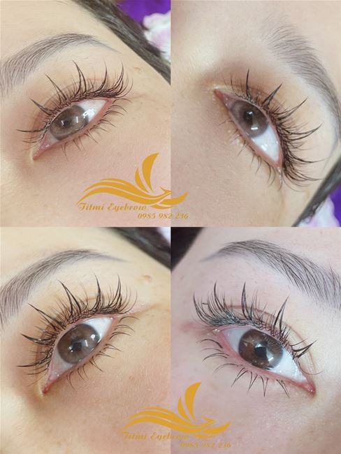 mi nối thiết kế lấy ý tưởng từ vương miện hiệu ứng như mặt trời tỏa ra xung quanh