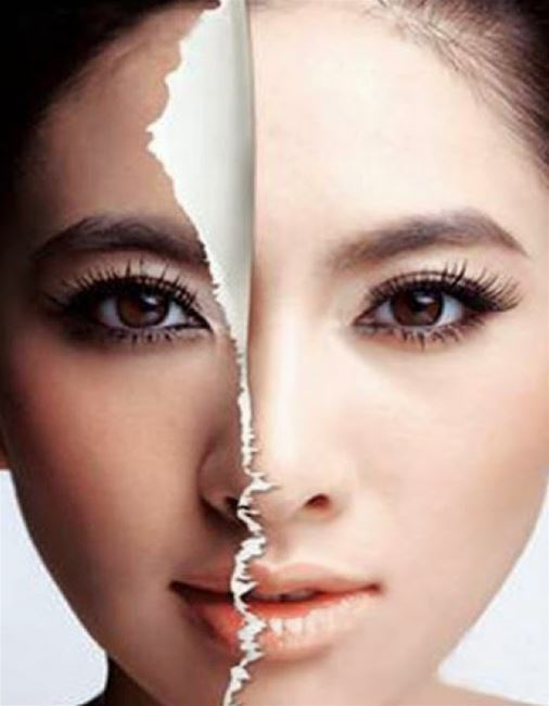 trị nám da mặt từ thảo dược siêu hiệu quả