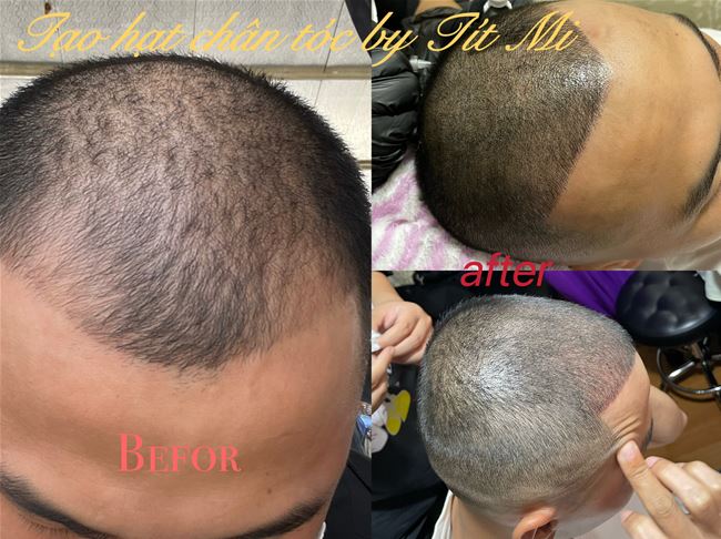 chạm hạt điêu khắc tạo sợi tóc ngắn đỉnh đầu cho tóc nam