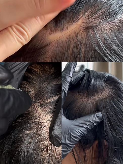 điêu khắc bằng hairstrocke rất hữu ịch có nền da khó như da sẹo da dâu điêu khắc bằng hairstrocke rất hữu ịch có nền da khó như da sẹo da dâu