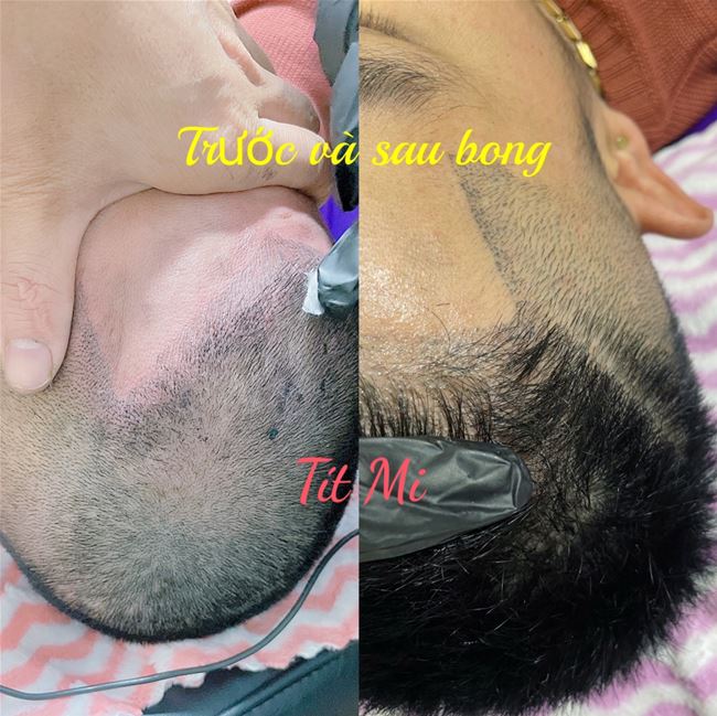 xăm điêu khắc  chân tóc sau bong tại Tít Mi