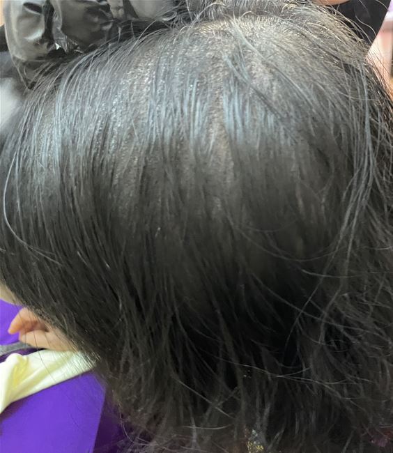 zoom cận cảnh từng hạt tóc dưới da nhé, che phủ tối ưu các vùng trắng của tóc và tạo hiệu ứng tóc dày dặn hơn