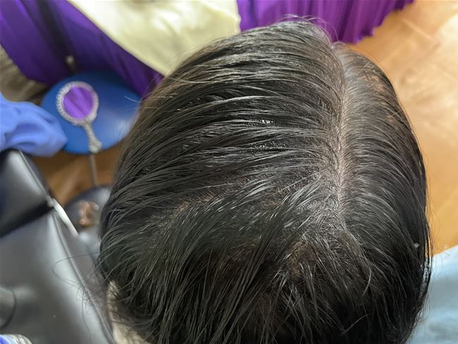 zoom cận cảnh từng hạt tóc dưới da nhé, che phủ tối ưu các vùng trắng của tóc và tạo hiệu ứng tóc dày dặn hơn