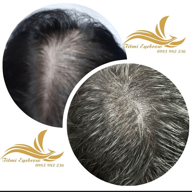 điêu khắc tạo hướng tóc cho vùng tóc thưa đỉnh đâu