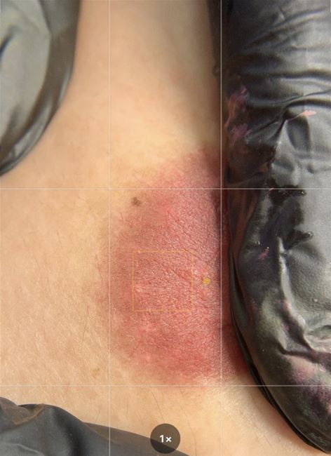 cận cảnh vào màu hồng nhũ hoa nhận rõ sự thay đổi sắc tố