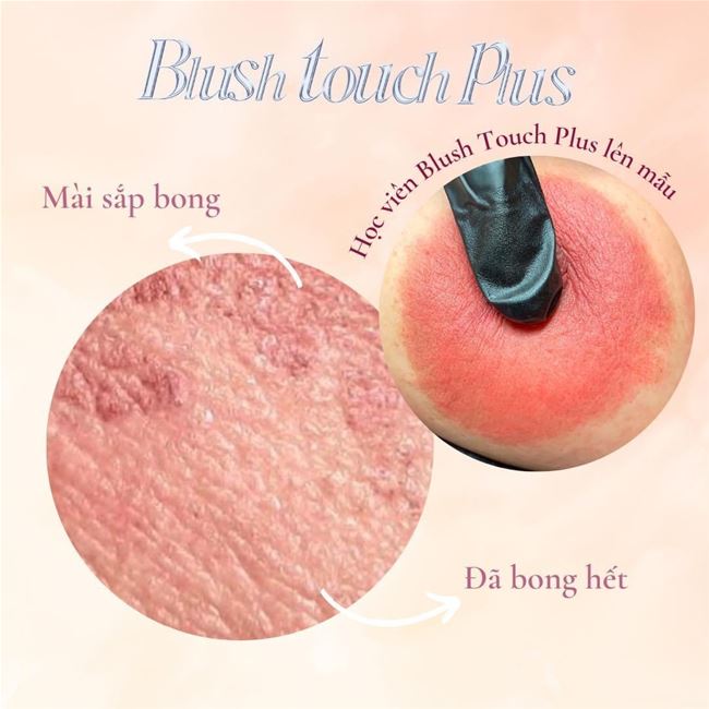 nhũ hoa đang bong và hồi phục