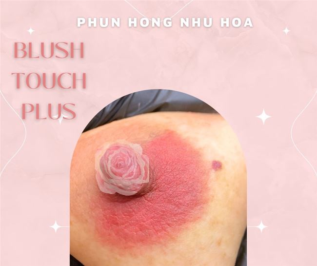 công nghệ phun chạm thay đổi sắc tố làm hồng nhũ hoa không phụ thuộc dưỡng