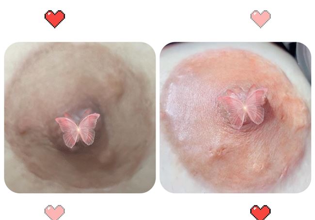 minh họa quy trình phun xăm làm hồng nhũ hoa - Tít Mi