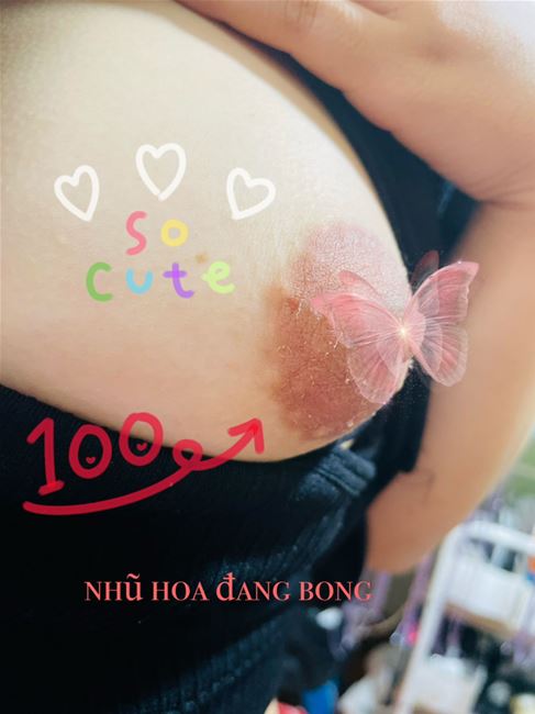 nhũ hoa bong li ti nhẹ nhàng không tổn thương sâu