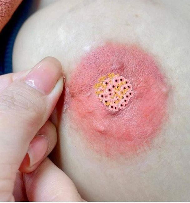 phun hồng nhũ hoa màu tự nhiên phun hồng nhũ hoa màu tự nhiên