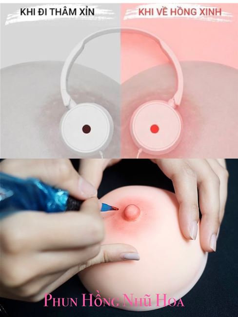 Hướng dân chia sẻ cách phun hồng nhũ hoa