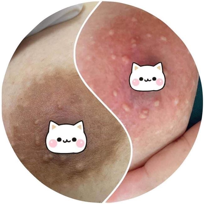 cửa hàng phun hồng nhũ hoa tại Ba Đình Hà Nội