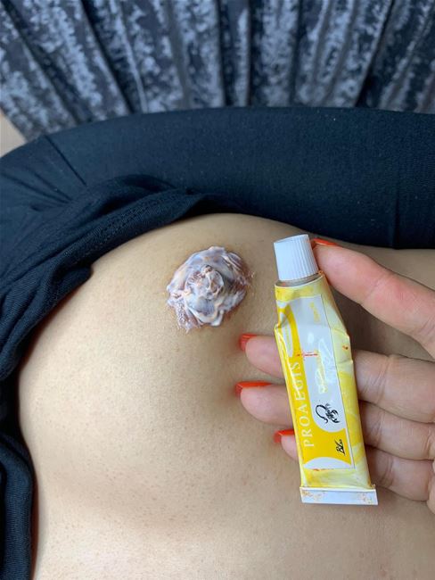 ủ tê  trước khi tiến hàng phun xăm làm hồng nhũ hoa