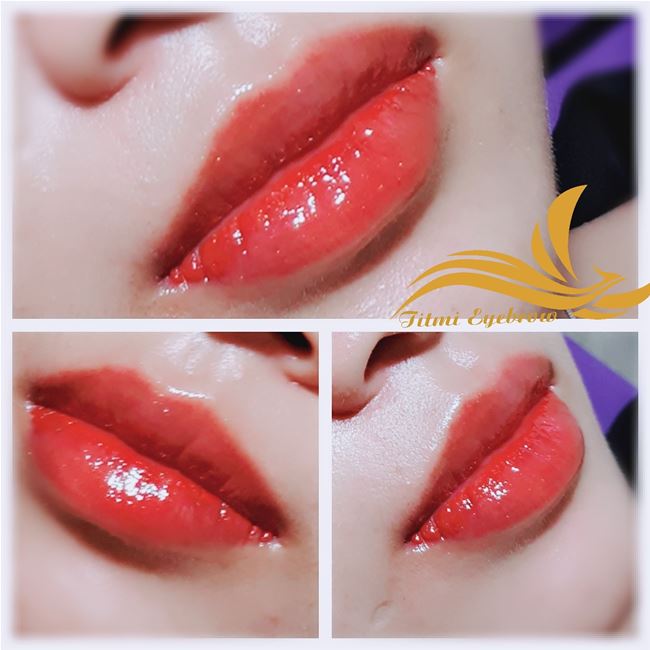 phun môi không đau không sưng