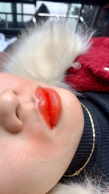 Kỹ Thuật phun siêu mịn không sưng không đau, Phun môi công nghệ vi chạm đâmh lòng môi, viên môi tan