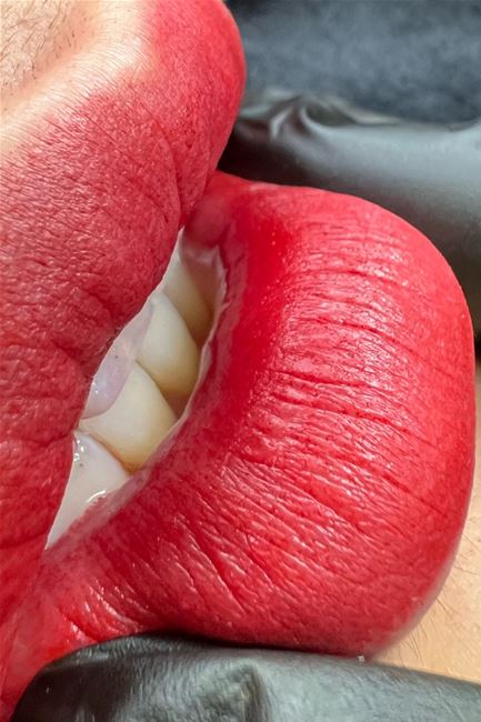 Kỹ Thuật phun siêu mịn không sưng không đau, Phun môi công nghệ vi chạm đâmh lòng môi, viên môi tan