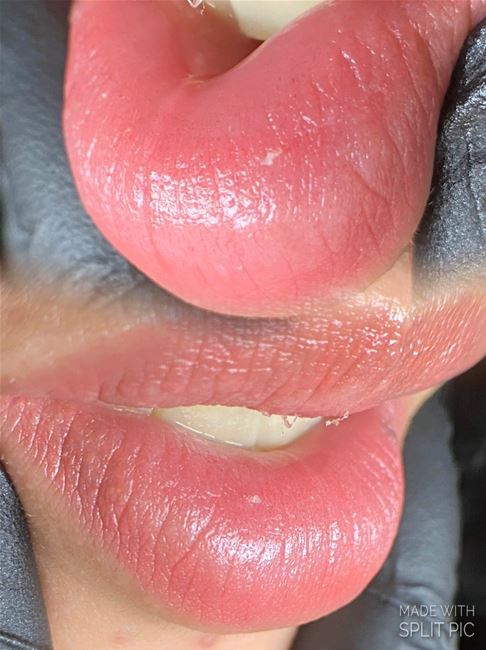 Hình ảnh Môi vừa phun khử thâm , cách phun mềm mịn