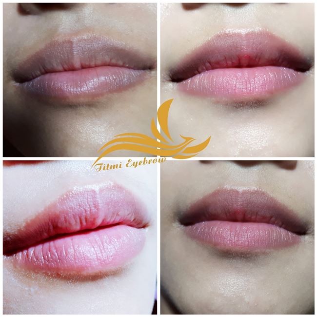 môi khử thâm nam nữ