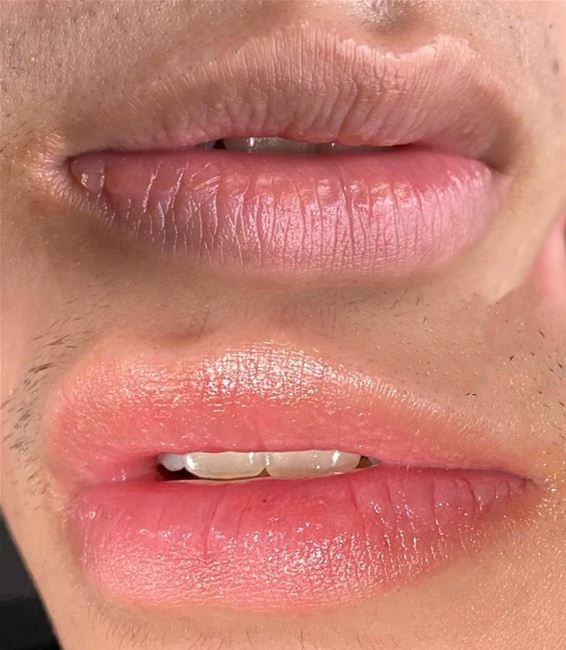 Môi nam khử thâm và vào màu nhẹ nhàng tự nhiên