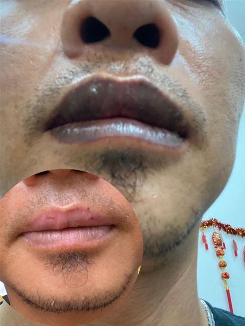 Môi nam chỉ khử thâm không vào màu