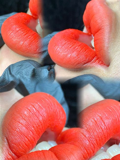 Phun môi không thể vĩnh viễn