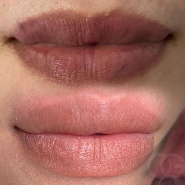 Bạn có thấy màu mực phun khử thâm màu hồng dâu có khác biệt