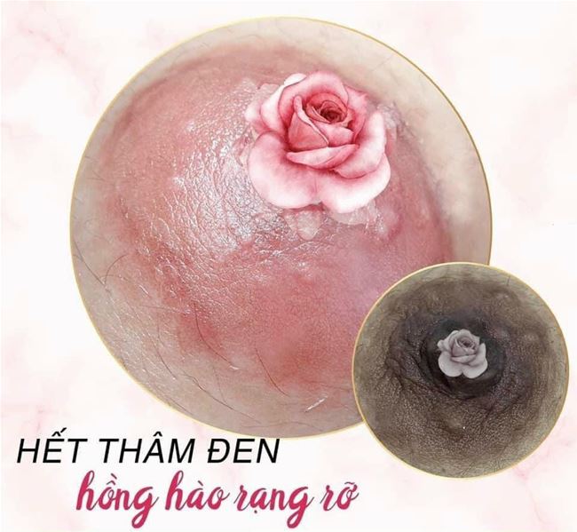 Hãy hiểu rõ về phương pháp phun xăm làm hồng nhũ hoa trước khi lựa chọn dịch vụ