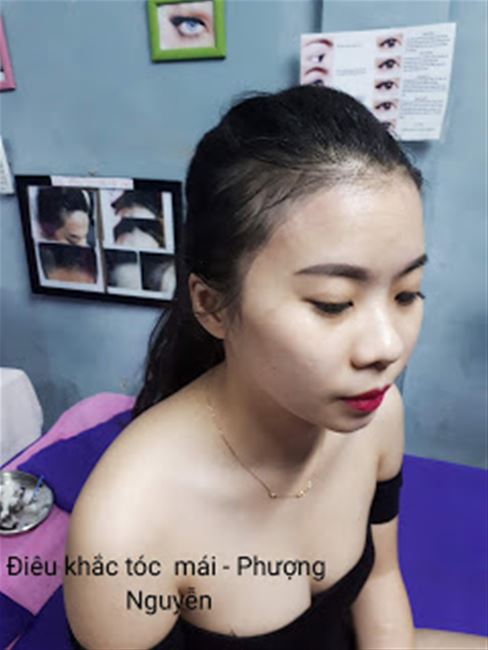 điêu khắc tóc che trán hói bướng