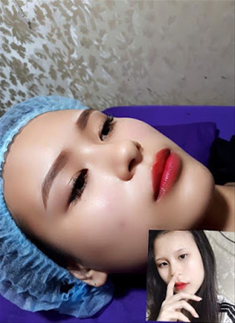 phun chân mày vi chạm