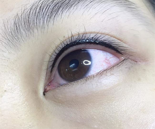 dieu khac mi mo trong