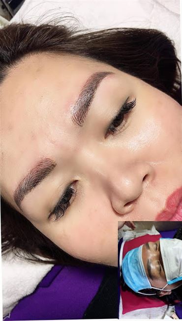 xóa swuar chân mày vũ hỏng