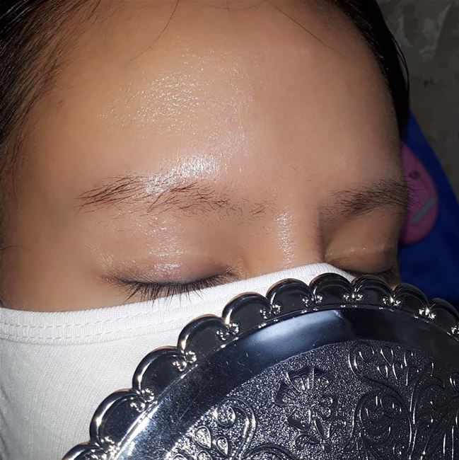 kết thúc liệu trình xóa châm mày sạch mực không sẹo, lông mọc tự nhiên