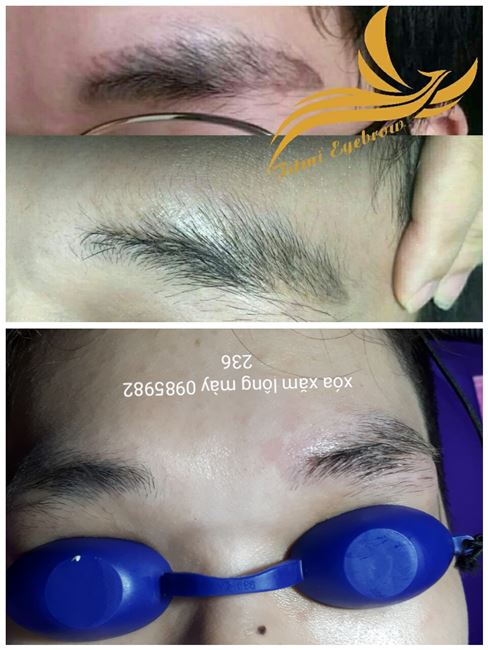 liệu trình xóa sạch chân mày điêu khắc nam bị hỏng liệu trình xóa sạch chân mày điêu khắc nam bị hỏng