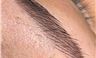 Tại sao kỹ thuật microblading lại gây nhiều thảm hoa Tại sao kỹ thuật microblading lại gây nhiều thảm hoa