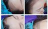 Điêu khắc đường chân tóc, thêu tóc 8d Điêu khắc đường chân tóc, thêu tóc 8d
