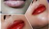 Sự Khác nhau giữa Xăm Môi và Phun Môi vi chạm Sự Khác nhau giữa Xăm Môi và Phun Môi vi chạm